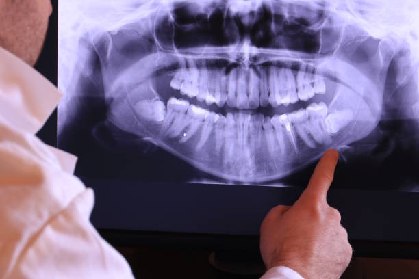 Best Weekend Emergency Dentist in Childersburg, AL