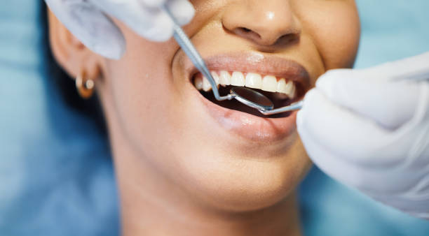 Best Emergency Treatment for Toothache in Childersburg, AL